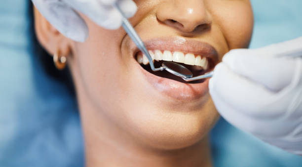 Best Emergency Wisdom Teeth Removal in Naugatuck, CT