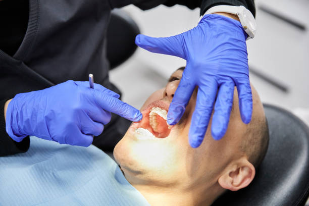 Best Emergency Dental Care for Broken or Chipped Teeth in Naugatuck, CT