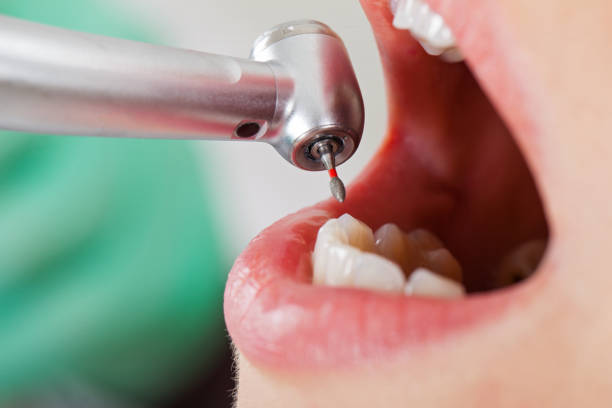Best Pediatric Emergency Dentist in Naugatuck, CT
